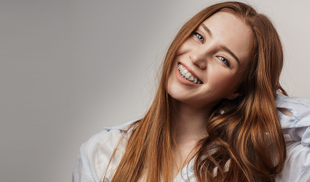 Cost of Braces East Los Angeles